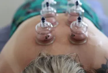 Remedial Massage with Cupping